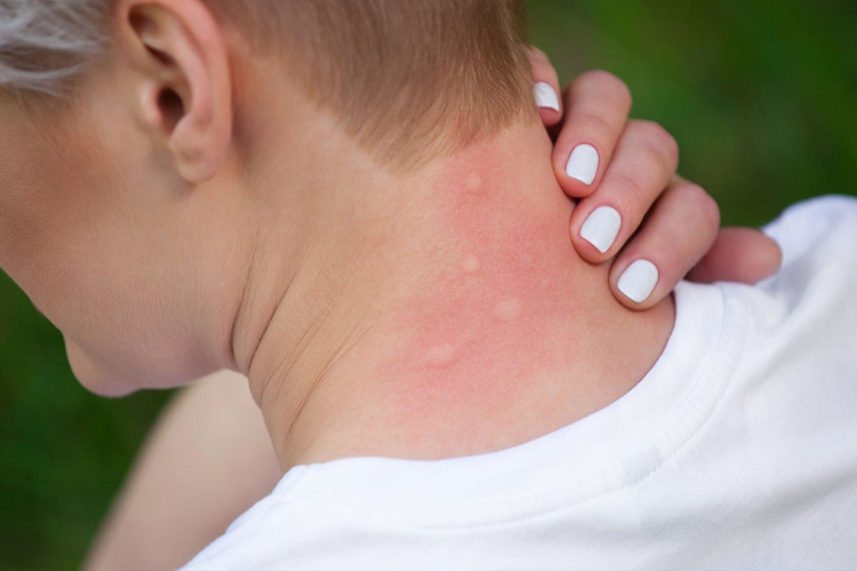 Mosquito Control Binghamton NY | A Great Choice